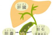 胆石症の原因と症状、治療内容について
